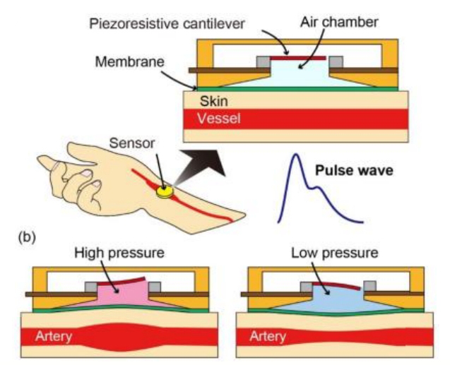 醫療行業設備實時監控壓感油墨,能夠精確測量0-100%形變和0-1000N力范圍